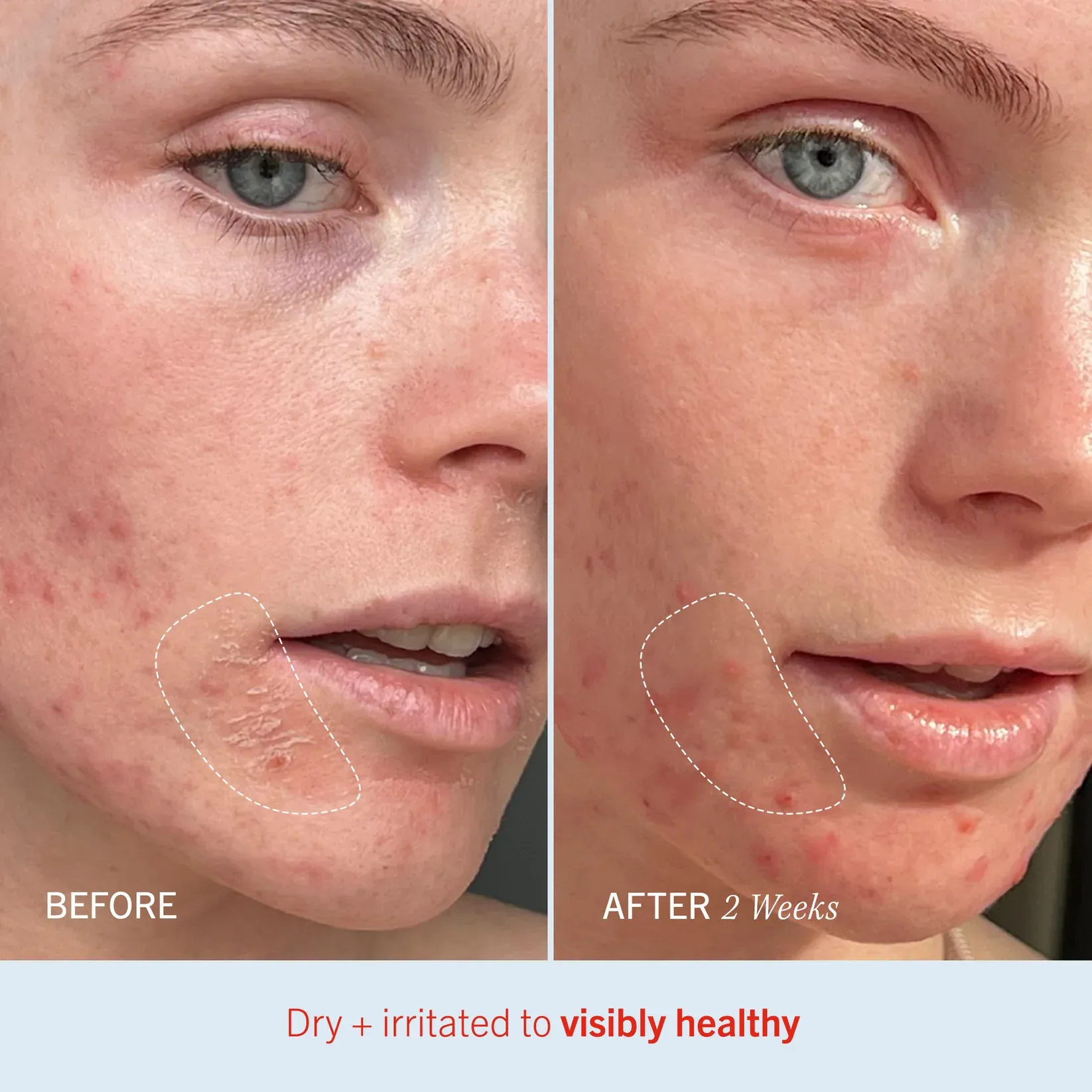 <span style='display: block; text-align: center;'>Visible Results</span>