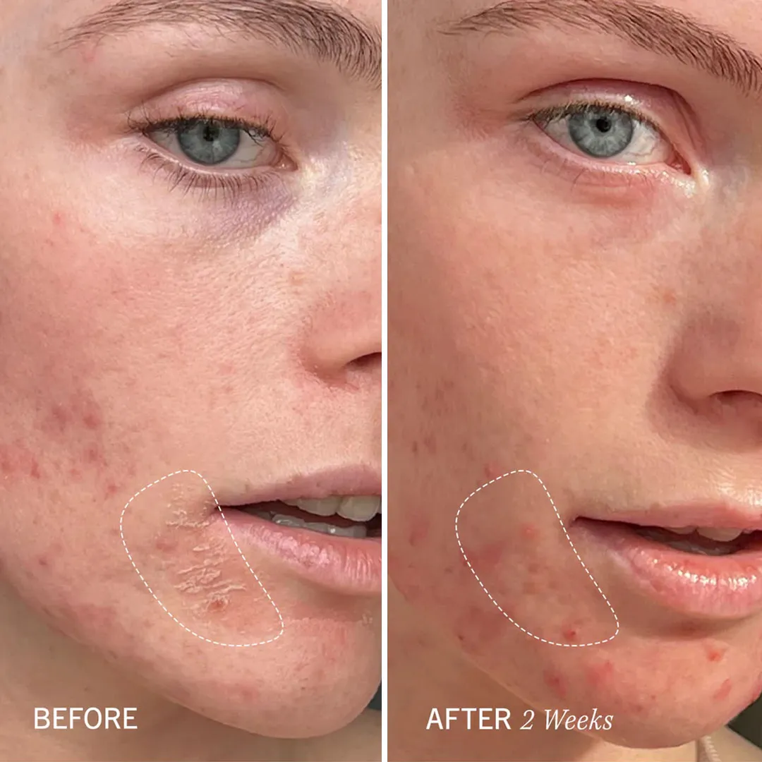 <span style='display: block; text-align: center;'>Visible Results</span>