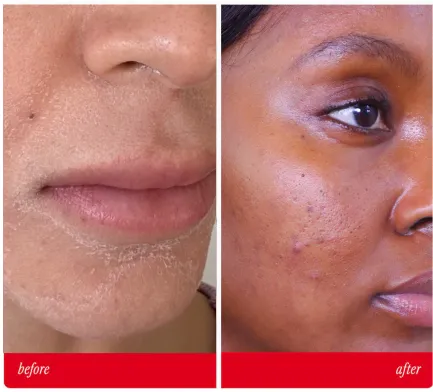 <span style='display: block; text-align: center;'>Visible Results</span>