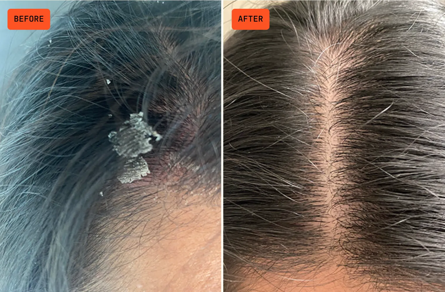 02. Treat Your Scalp Like Skin