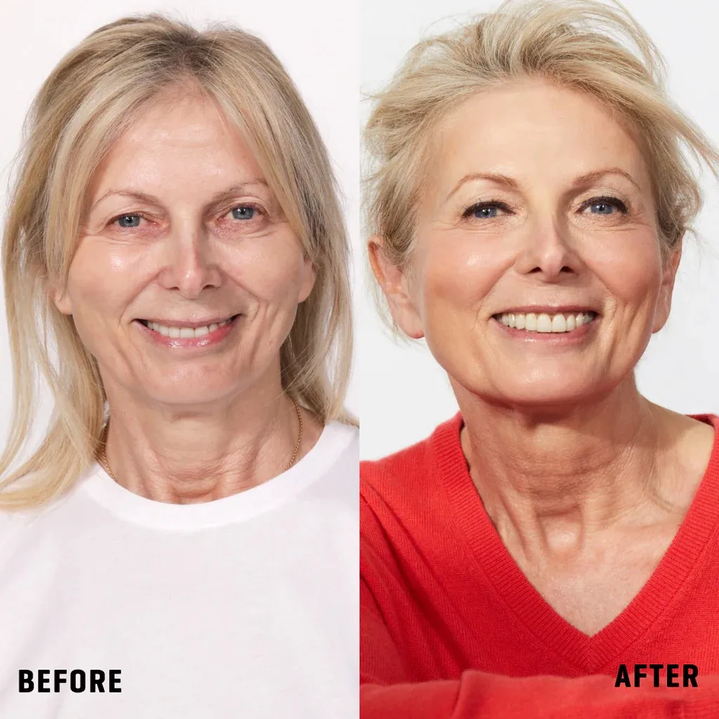 <span style='font-size: 44px; font-weight: 600;'>5.</span>
It Helps Your Skin Look Healthier Over Time