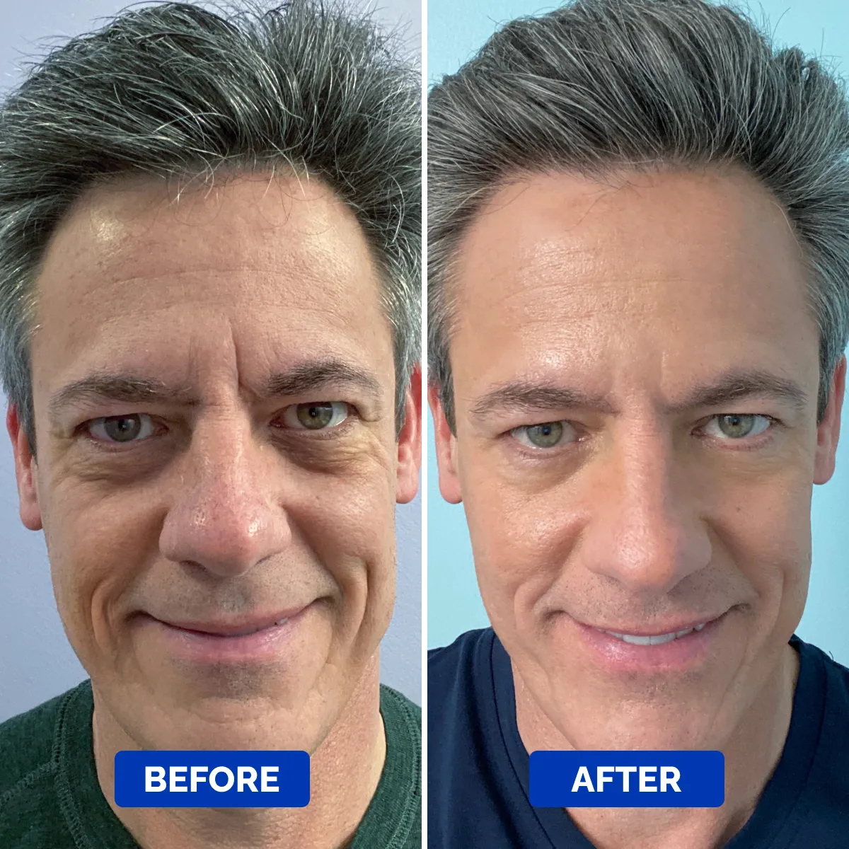 Smarter Skincare Starts Here